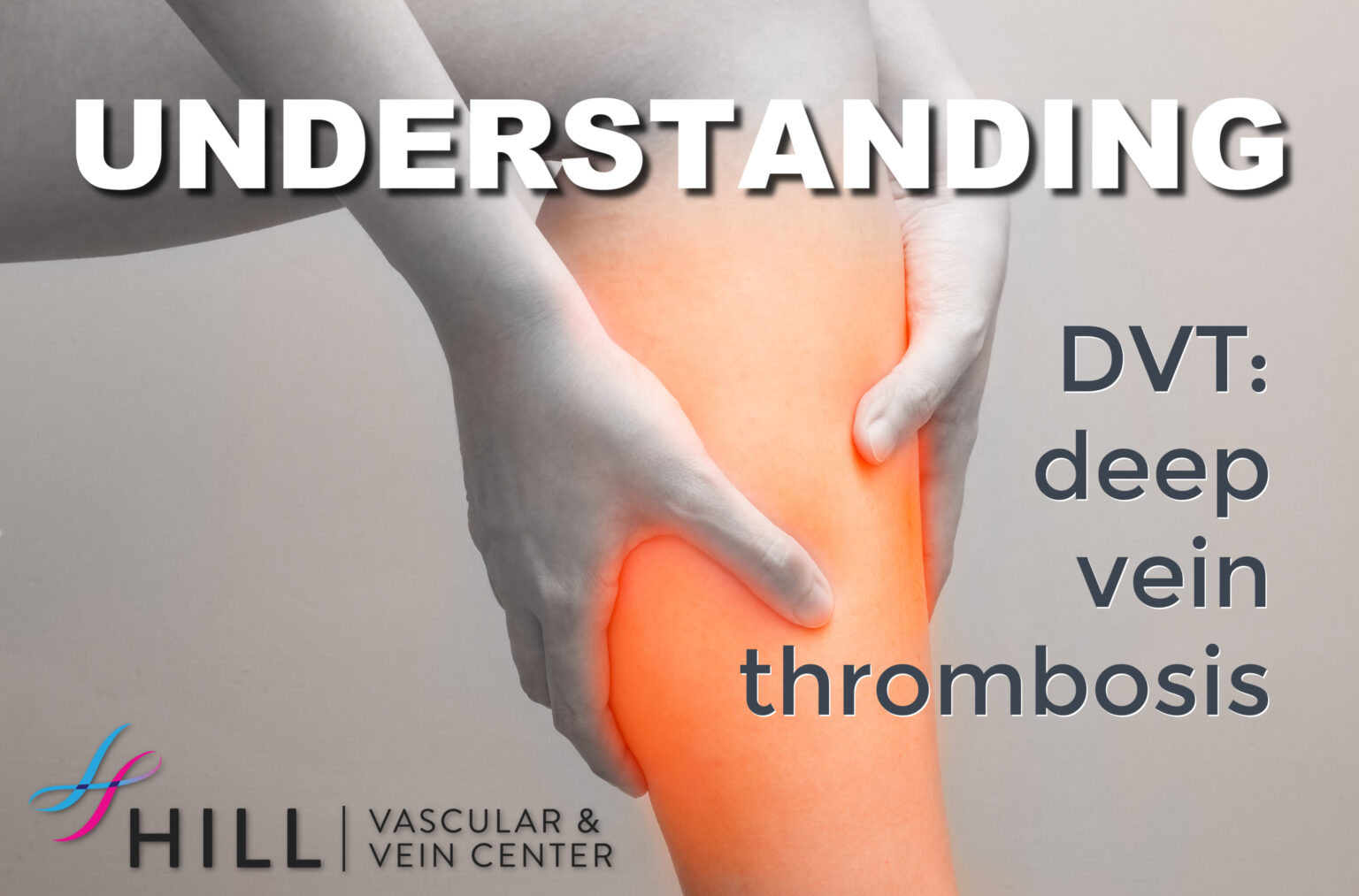 Deep Vein Thrombosis Dvt Hill Vascular And Vein Center